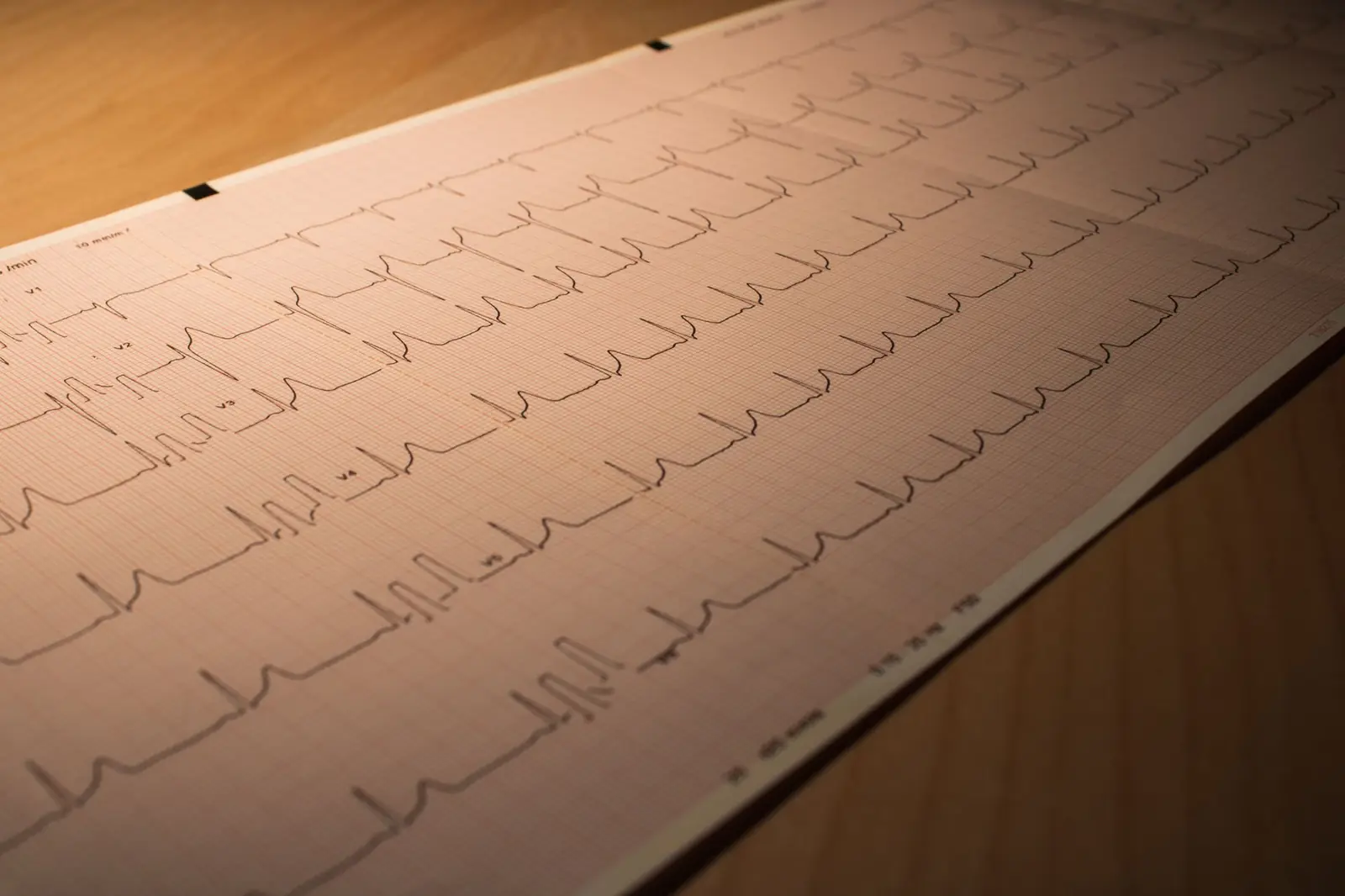 A long printed ECG strip lying across a warm wooden table