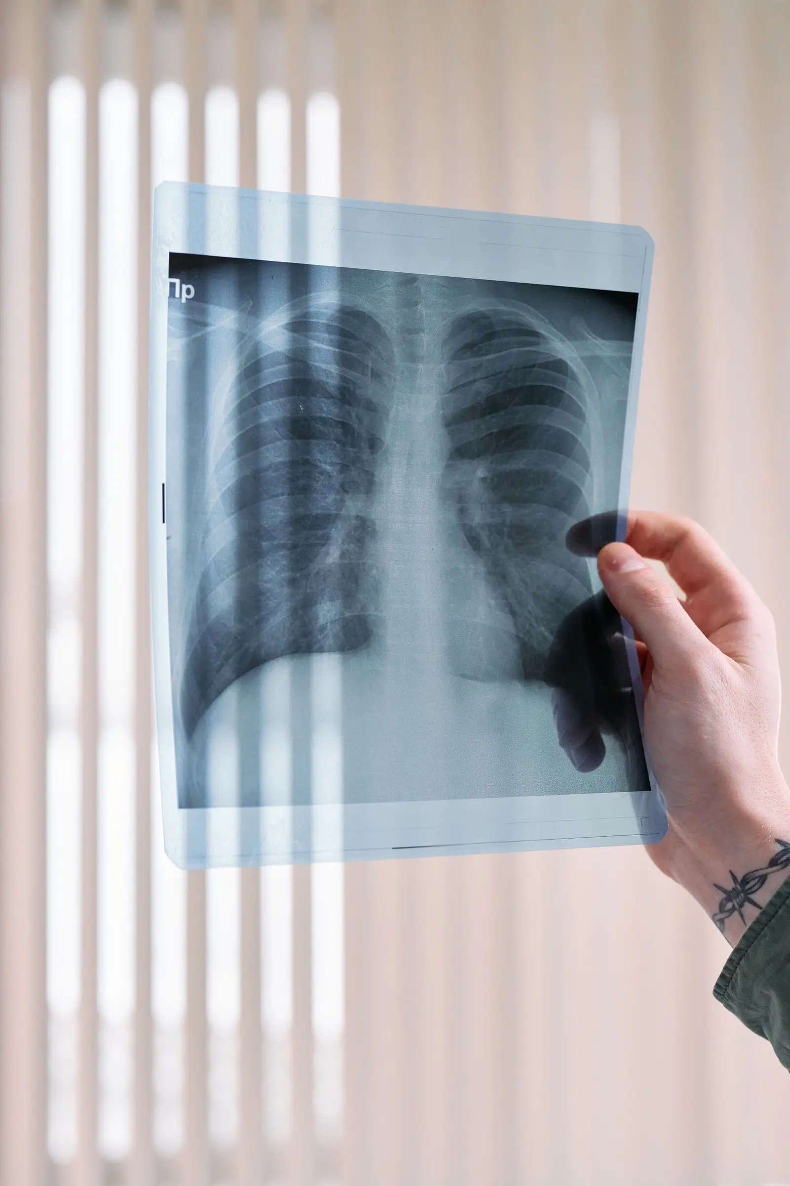 A hand holding a chest X-ray up to window light.