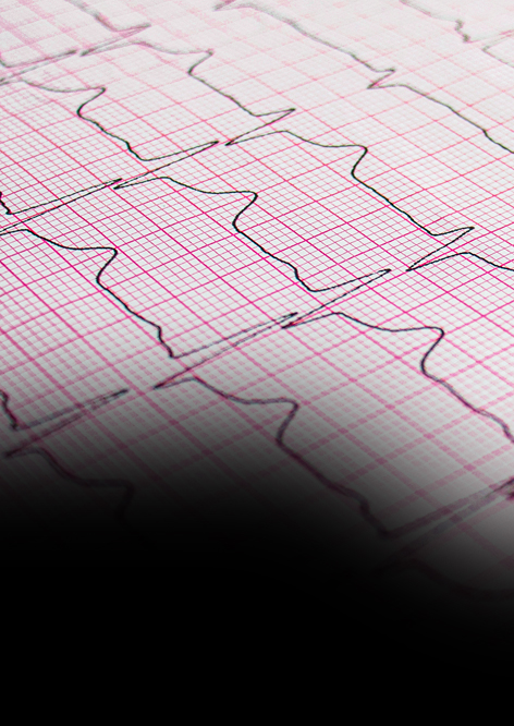 Electrocardiograms